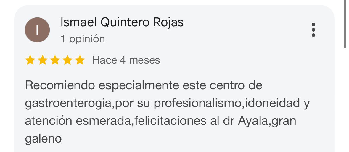 Opinión Ismael
